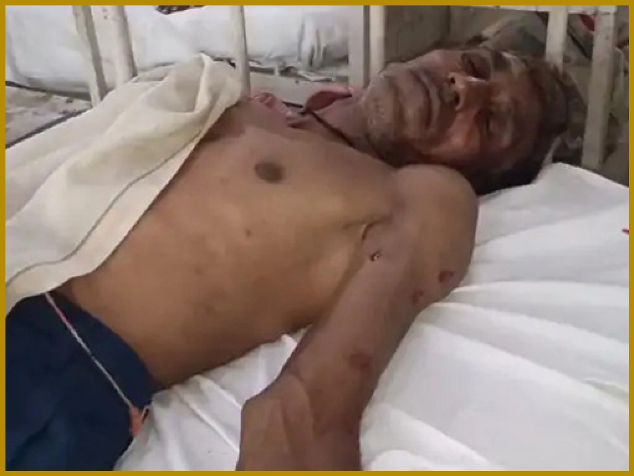 Leopard Attack Leaves Villager Injured, Fear Grips Local Community